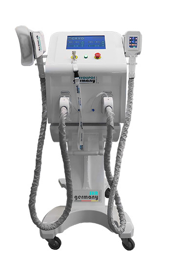 KRYOLIPOLYSE Mobile